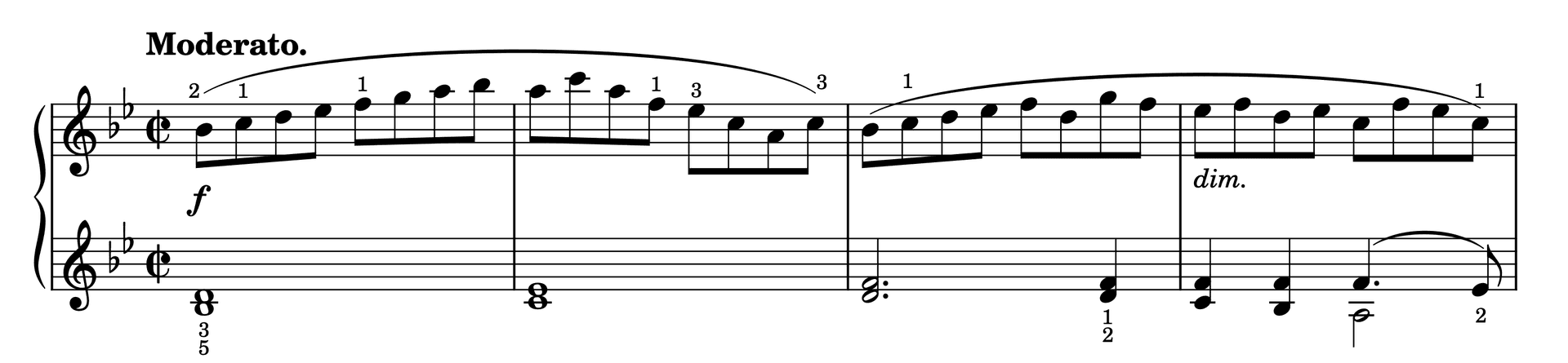 Excerpt of Etude in B-flat Major Op. 37, No. 30