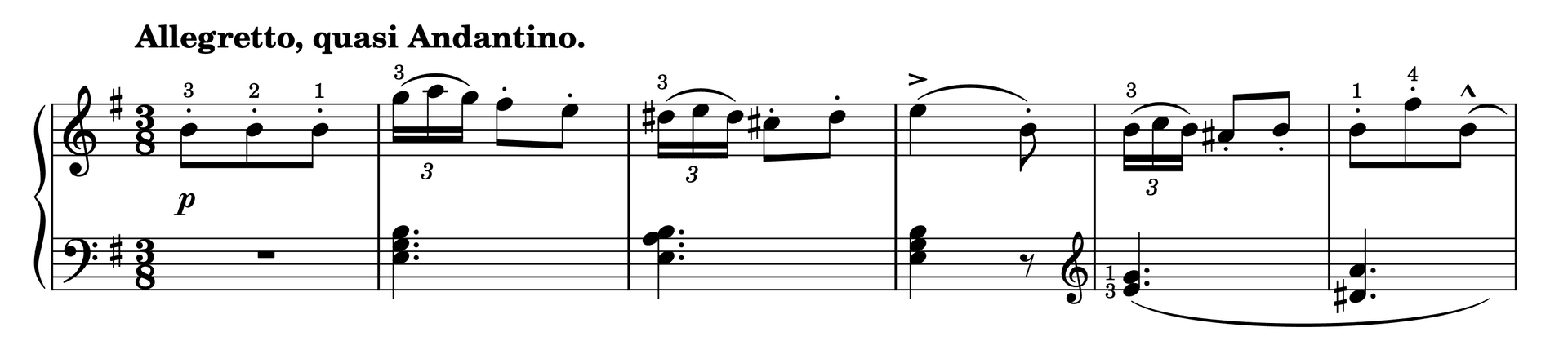 Excerpt of Etude in E Minor Op. 37, No. 34